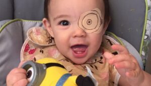 Penanganan Mata Malas pada Anak (3)