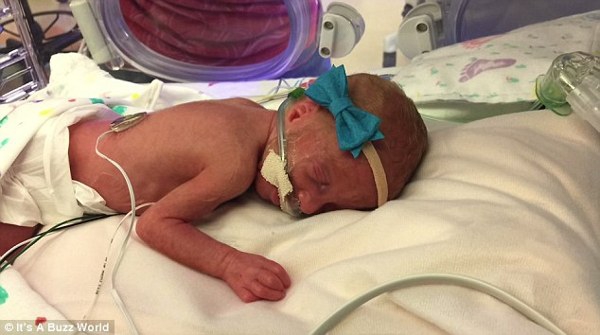 Bayi Kembar 5 Lahir di Amerika