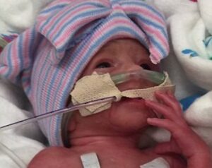 Bayi Kembar Lima Lahir di Amerika