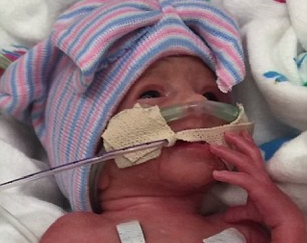 Bayi Kembar Lima Lahir di Amerika