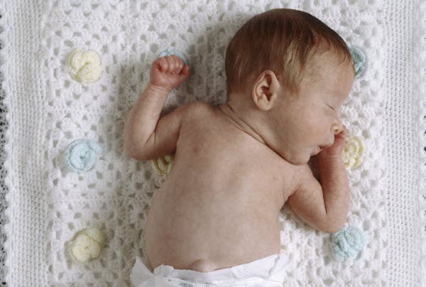 Penuhi Kebutuhan Zat Besi Si Kecil: Siapa Rentan Rekena? (3)