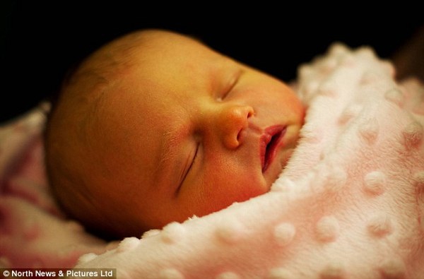 Waspadai Tanda Lahir di Kulit Bayi Anda!