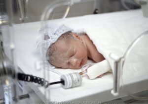 Neonatal Sepsis (2): Gejala dan Faktor Risiko