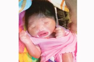 Bayi “Plastik” Lahir di India