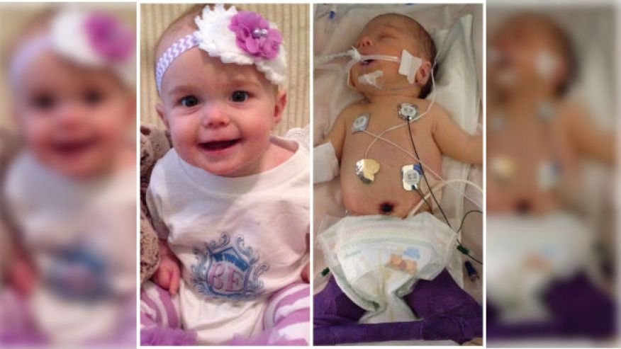 Bayi dengan Kandung Kemih di Luar Tubuh