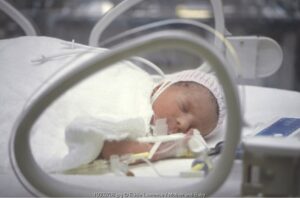 Neonatal Sepsis (1): Proses dan Waktu Terjadinya