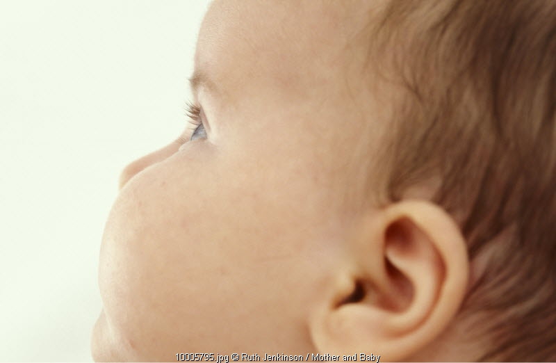 Tips Mencegah Infeksi Telinga pada Bayi