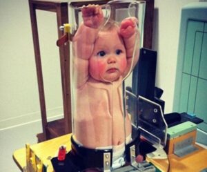 Bayi Sedang X-Ray Undang Tawa Pengguna Internet