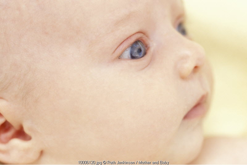 Perawatan Mata Merah pada Balita