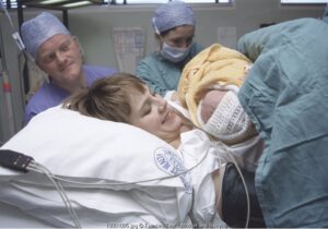 Inisiasi Menyusui Dini Pasca Caesar