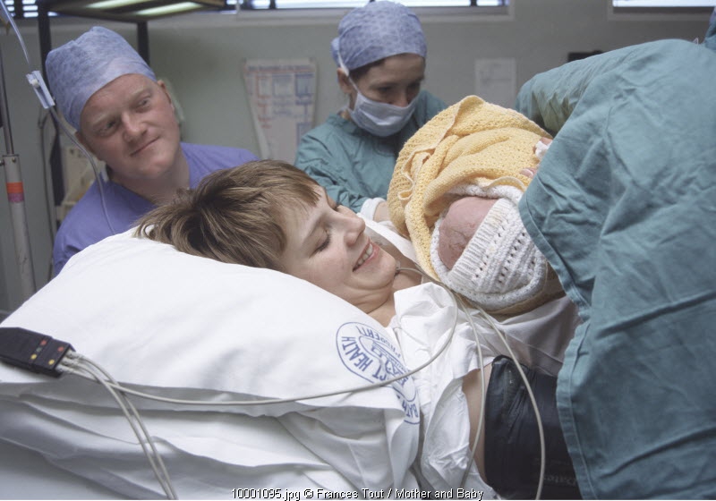 Inisiasi Menyusui Dini Pasca Caesar