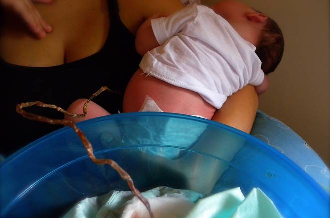 Pro dan Kontra Lotus Birth