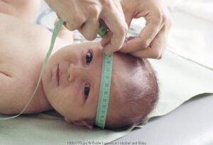 Kenali Stunting Sejak Dini