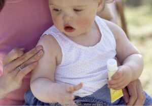 Waspada, Infeksi Kulit Pada Anak Bisa Menular!