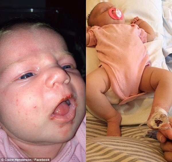 Hati-Hati Jika Orang Lain Mencium Bayi Anda!