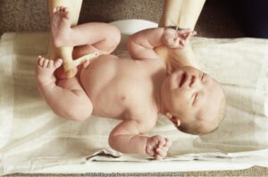 Trauma Lahir (3): Pada Wajah Bayi