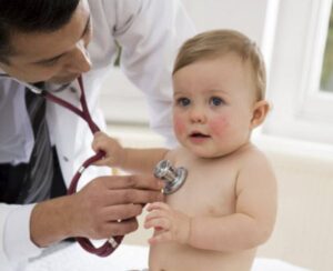 Penanganan TBC pada Anak