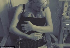 Ibu Penderita Kanker Berhasil Melahirkan Bayi Kembar