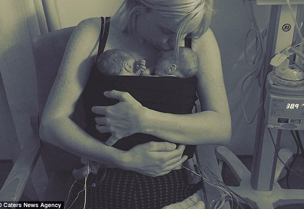 Ibu Penderita Kanker Berhasil Melahirkan Bayi Kembar