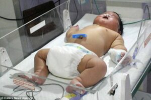 Ibu di India Melahirkan Bayi 6,7 kg Lewat Persalinan Normal