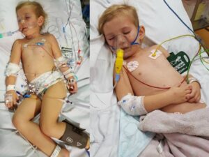 Hanya Dalam 24 Jam, Meningitis Melumpuhkan Balita Ini!