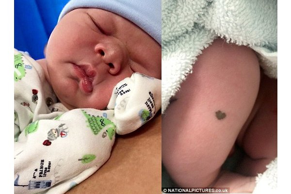Unik! Bayi Ini Memiliki Tanda Lahir Berbentuk Hati