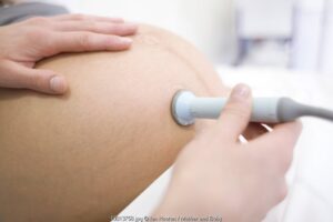 Pemeriksaan yang Dilakukan Jelang Persalinan