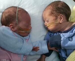 Bayi Kembar Selamat Berkat Dibungkus ‘Kantong Sandwich’