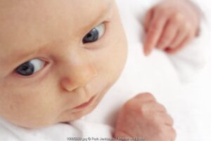 Katarak juga Bisa Menyerang Bayi