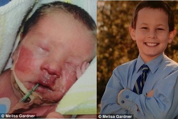 Simak Pengalaman Mengharukan para Ibu dengan Bayi Prematur!