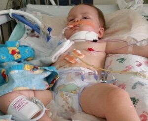 Kerongkongan Balita Hangus Akibat Menelan Baterai