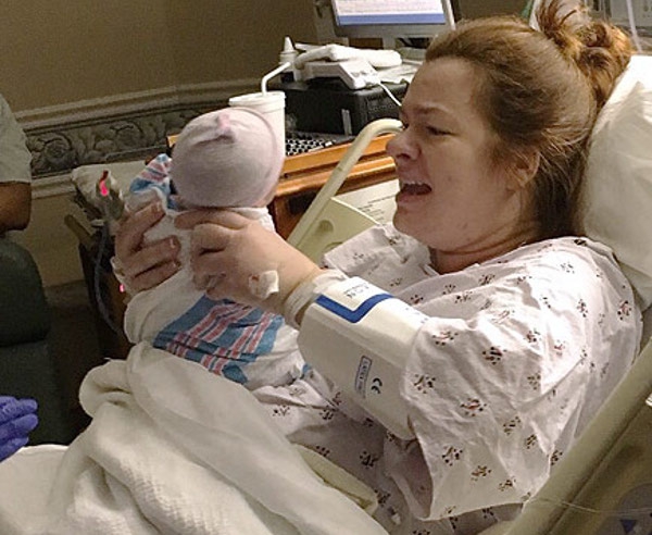 Dokter di Amerika Salah Mengoperasi Bayi!