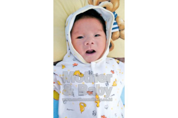 Kelainan Jantung, Bayi Ini Dioperasi Berkali-Kali