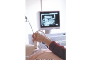 Penyebab Pertumbuhan Janin Terhambat