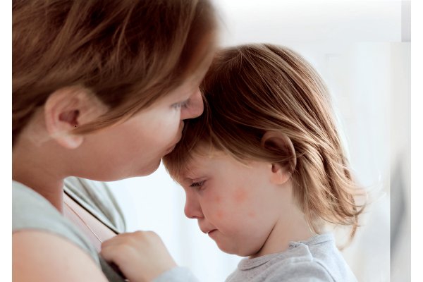 Kenali Cara Pencegahan Alergi