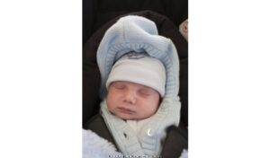 Mengapa Mata Bayi Baru Lahir Berair dan Lengket?