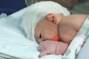 Bayi dengan Kelainan Tabung Saraf Mampu Bertahan Hidup