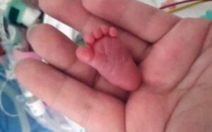 Emilia Si Bayi Termungil di Dunia