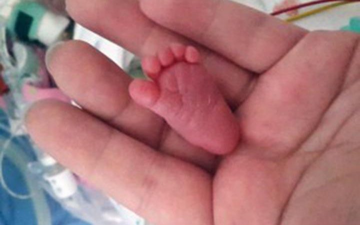 Emilia Si Bayi Termungil di Dunia