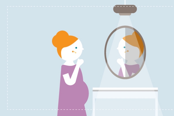 Atasi Jerawat saat Hamil