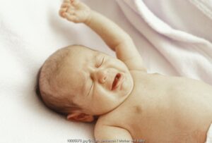 3 Trauma Lahir pada Kulit Bayi