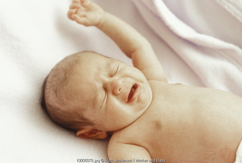 3 Trauma Lahir pada Kulit Bayi