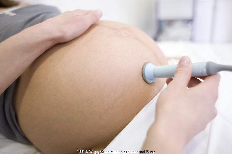 Hadapi Persalinan Prematur