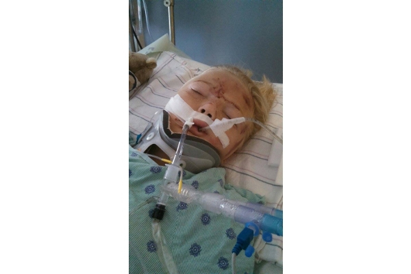 Tidak Pakai Car Seat, Anak Ini Terluka Parah!