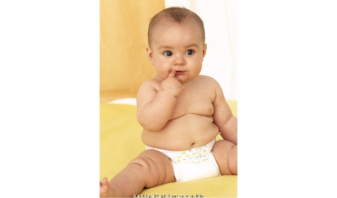 Kenali Ciri-ciri Obesitas pada Anak