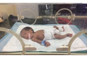 Aksesori Penting untuk Bayi Prematur