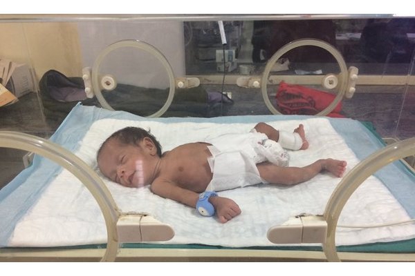 Aksesori Penting untuk Bayi Prematur