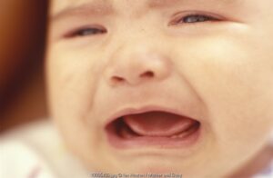 Pertolongan Pertama pada Luka Bakar Anak