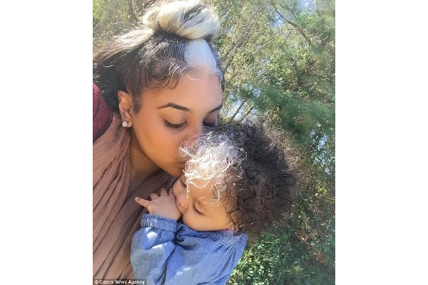 Turunan Ibunya, Bayi Ini Beruban