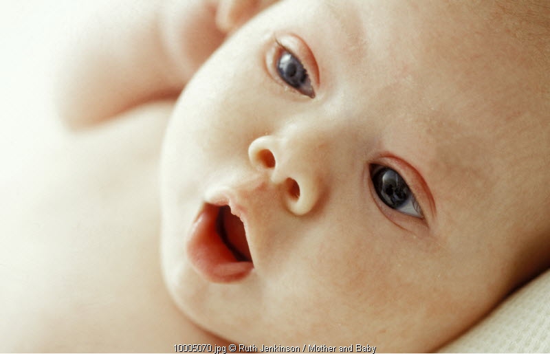 Waspadai Bercak Putih di Mulut Bayi